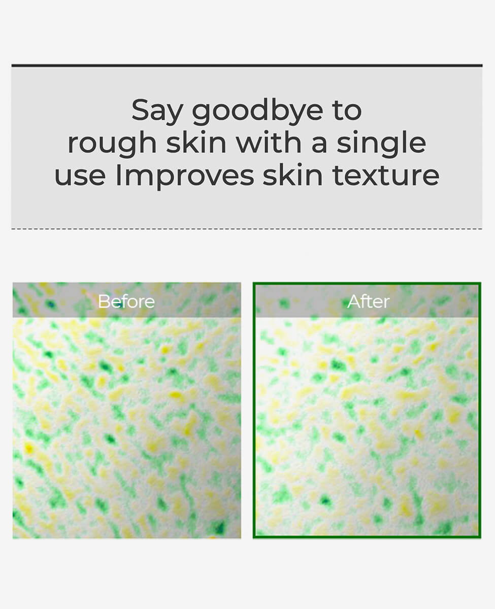 VT Cosmetics Reedle Shot 100